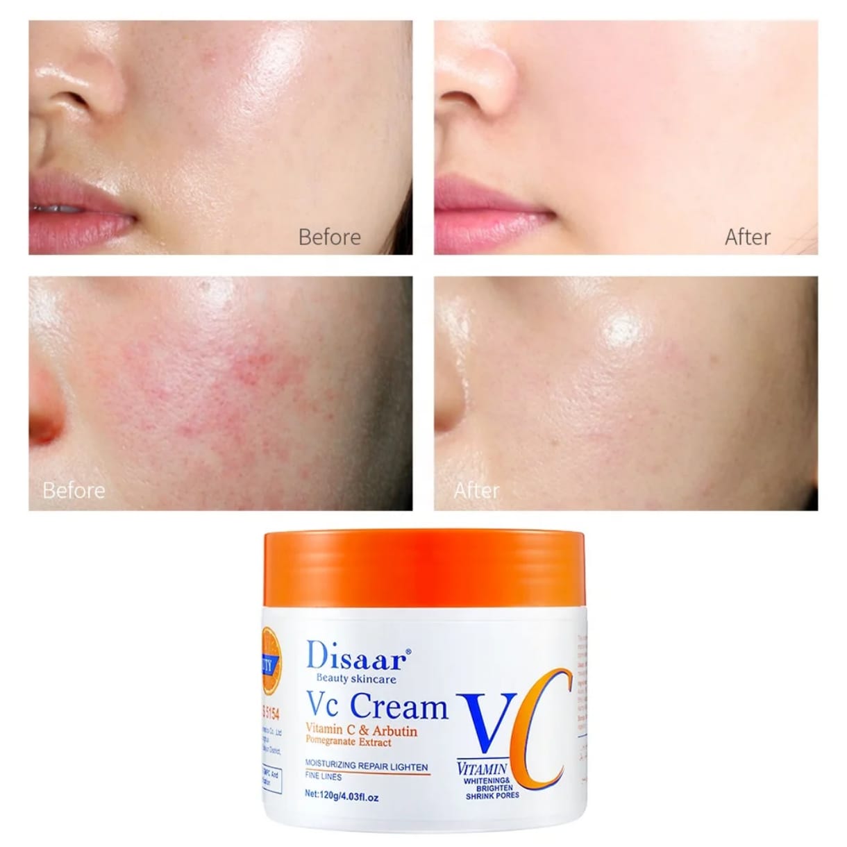 Disaar Crème Eclaircissante à la vitamine C pour le visage, élimine les taches foncées, anti-âge, soins de la peau 120g