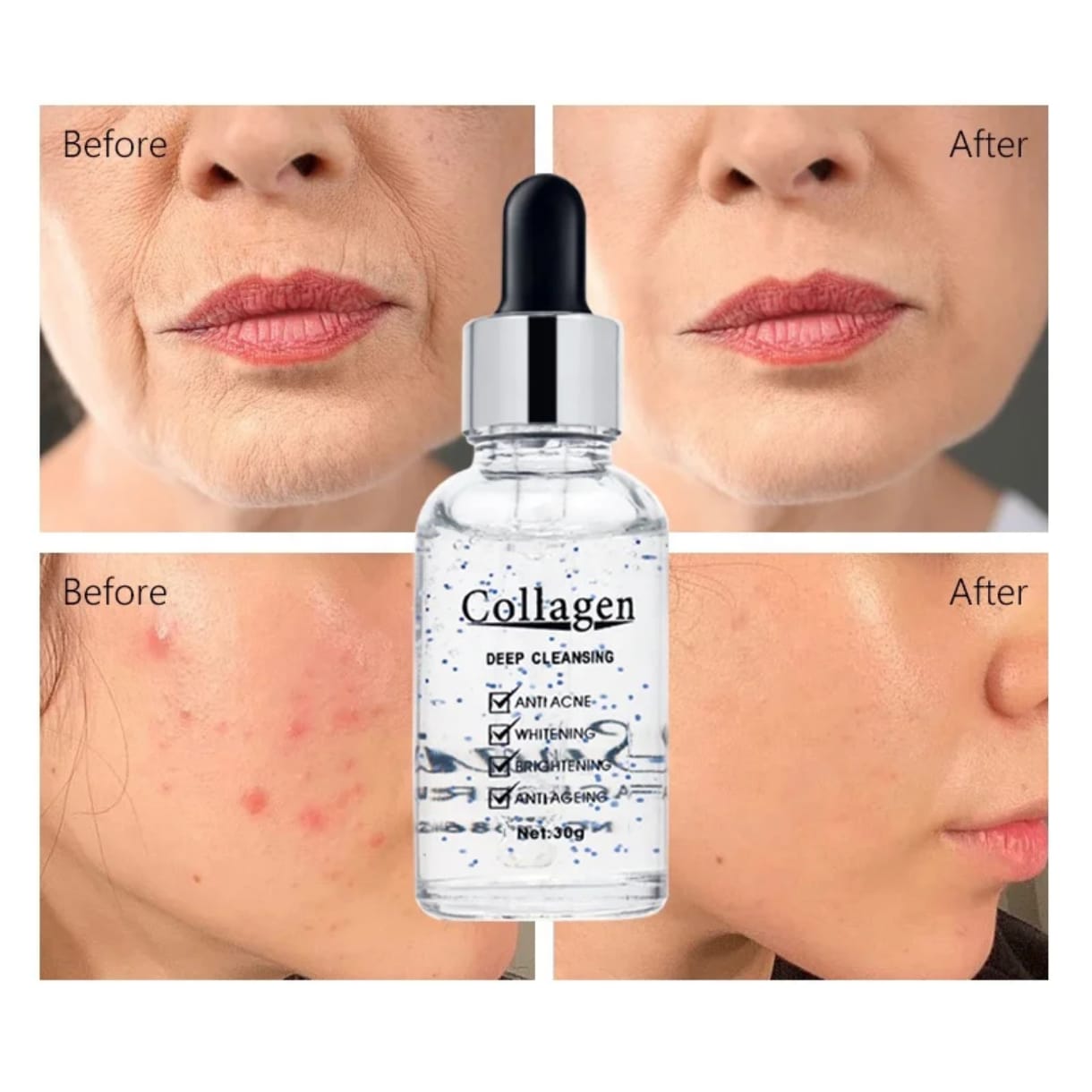 Sérum Escargot Collagène Visage Anti Acné/ Éclaircissant/ Anti-Vieillissement Soins de La Peau et du Visage Supprime Les Cicatrices D'acné/ Sérum Naturel 30 ML