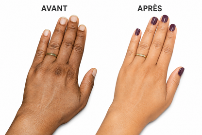 Maney -Goutte Blancheur Maney – Accélérateur d'Éclat