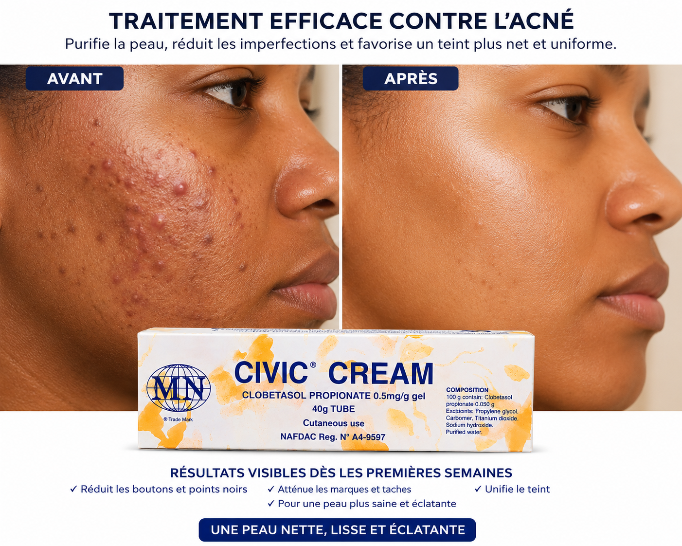 Civic Crème Visage – Acné, boutons et taches