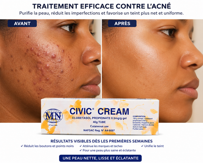Civic Crème Visage – Acné, boutons et taches
