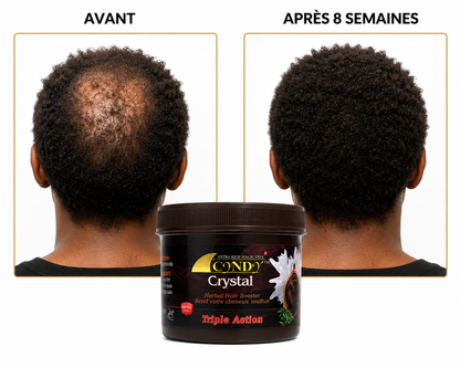 CONDY Crystal – Herbal Hair Booster Triple Action 250ml